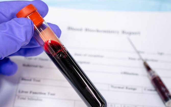 Анализ крови на креатинин