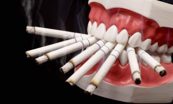 болезнь курильщика - лейкоплакия