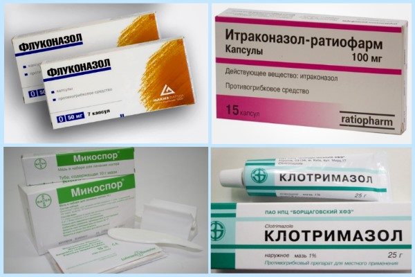 эксфолиативный хейлит (главный ключ)