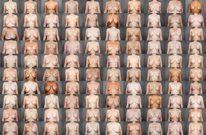 Форма груди