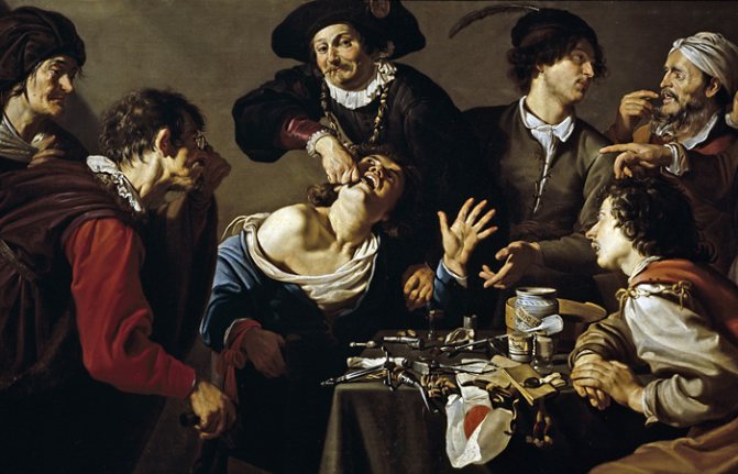 Фрагмент картины Теодора Ромбоутса 'Удаление зуба', XVII в.