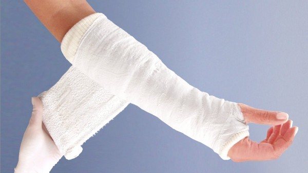 гипсовая повязка на руке