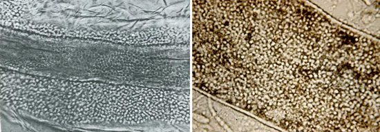 грибки трихофитон могут поражать как внешнюю, так и внутреннюю структуру волос