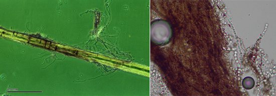 Грибок микроспорум в волосе