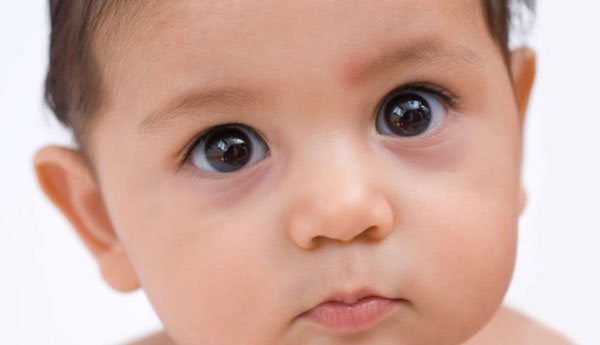 Грудной ребенок с мешками под глазами
