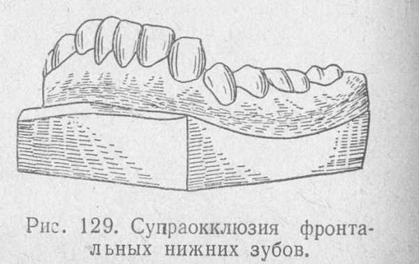 Характеристики аномалии