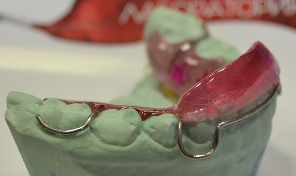 Как устанавливается аппарат Брюкля