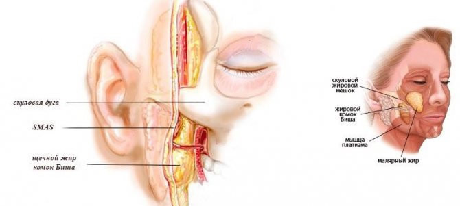 комки биша схема