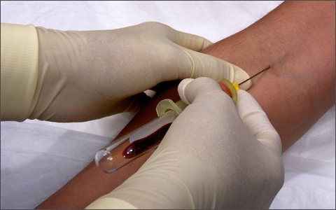 Креатинин норма в крови