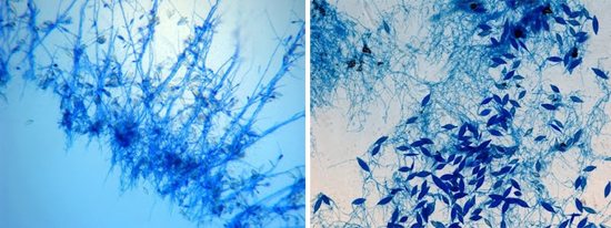 микроспорум пушистый