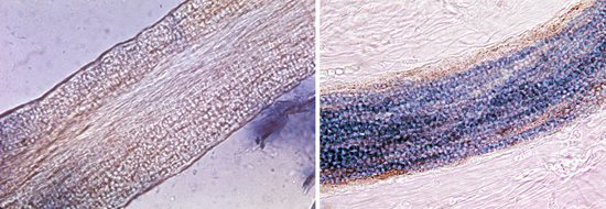 микроспорум в волосах