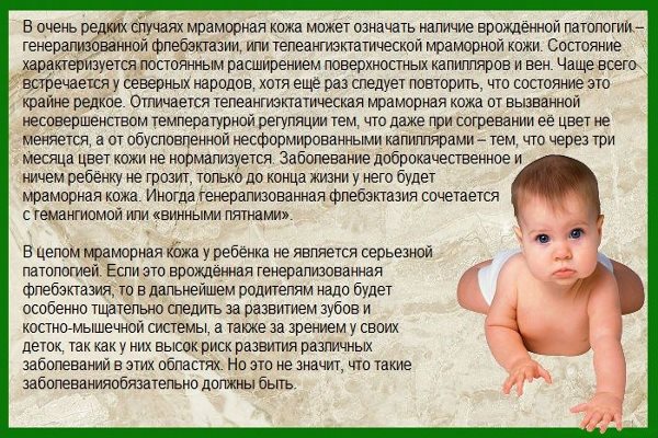 О мраморной коже