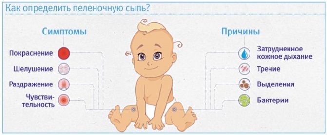 Пеленочный дерматит у новорожденных. Фото, лечение, клинические рекомендации