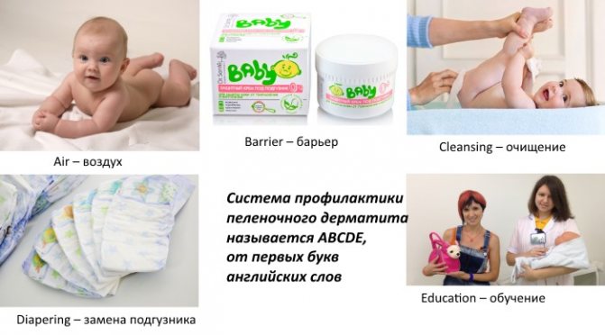 Пеленочный дерматит у новорожденных. Фото, лечение, клинические рекомендации