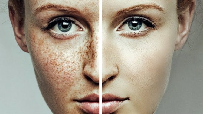 Пилинг лица. Очищающие кожу рецепты с лимоном. Правила приготовления и применения