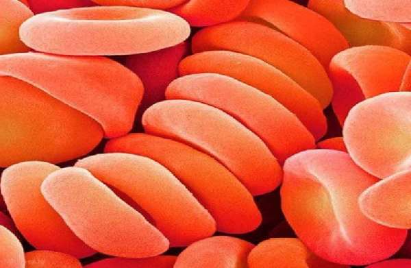 Полицитемия