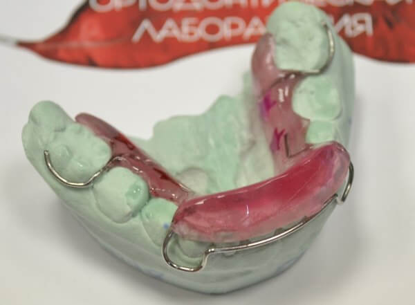 Положение аппарата Брюкля в полости рта