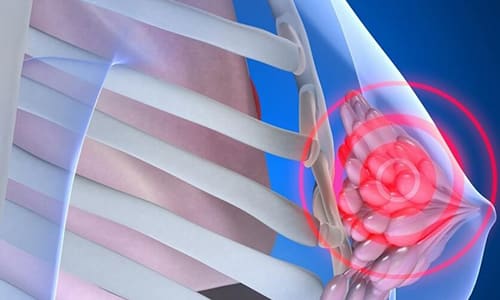 При длительном приеме препарат может предотвратить рост кист, патологических новообразований в тканях молочной железы