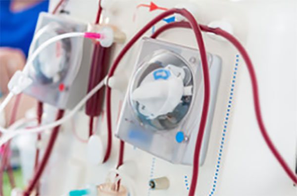 Прибор гемодиализа