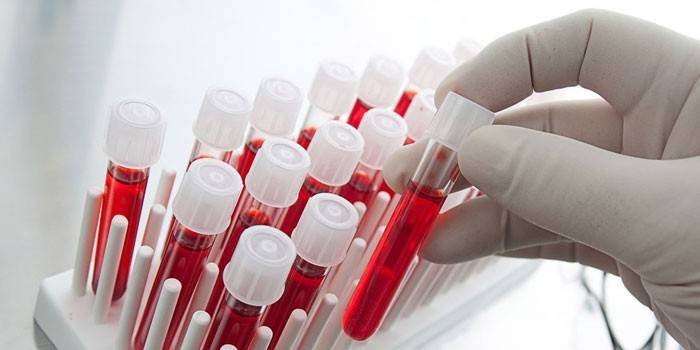 Пробирки с кровью