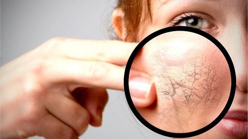 Пятна на лице красного цвета. Шелушатся участки кожи. Лечение кожи