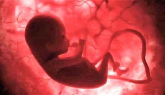 развивающийся плод