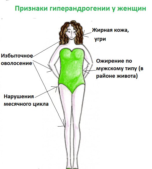 симптомы гиперандрогении