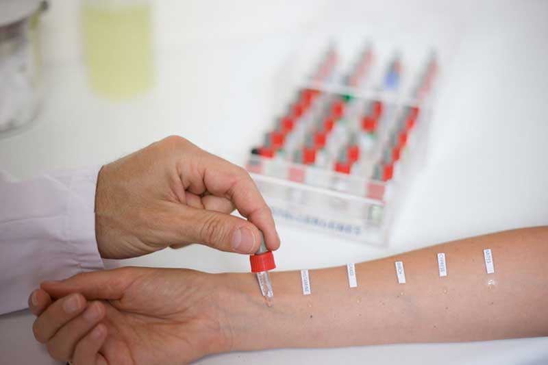 Симптомы и лечение аллергического дерматита у взрослых