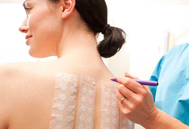 Симптомы и лечение аллергического дерматита у взрослых