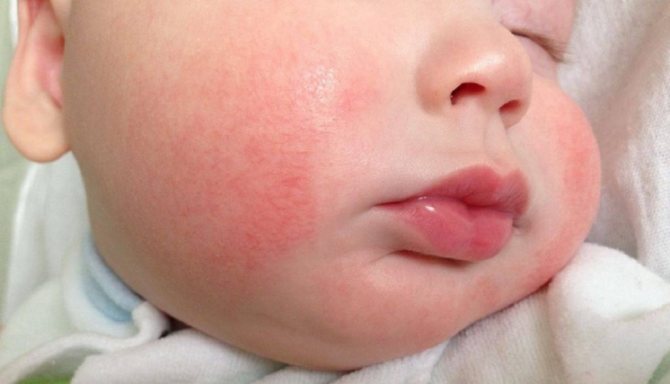 Сироп стоптуссин-фито инструкция по применению для детей и взрослых, аналоги, состав, отзывы