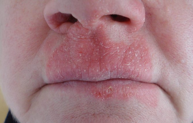 сухая форма