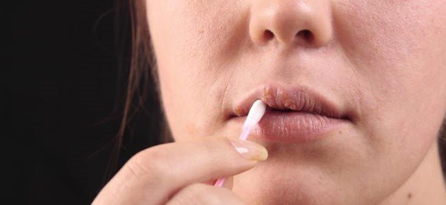 сухая форма