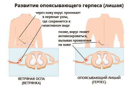 Сухие пятна на коже: шершавые, красные, белые, темные. Фото, причины и лечение у взрослых и детей