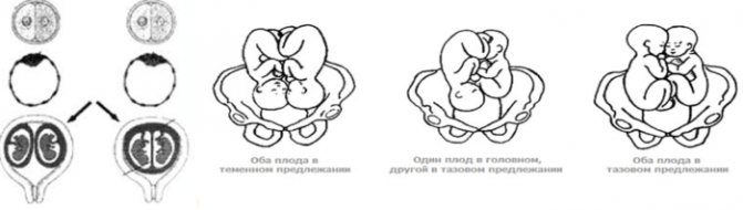 течение многоплодной беременности