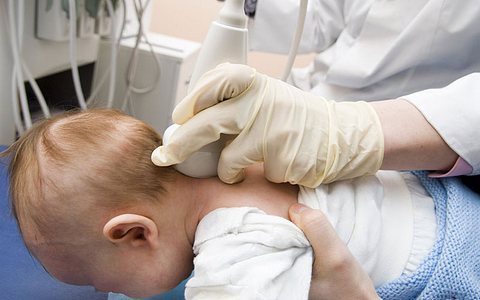 УЗИ головного мозга грудничку