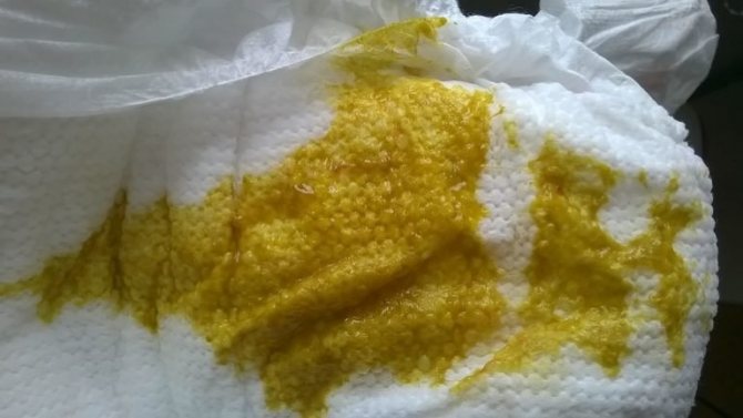 жидкий стул у грудничка норма