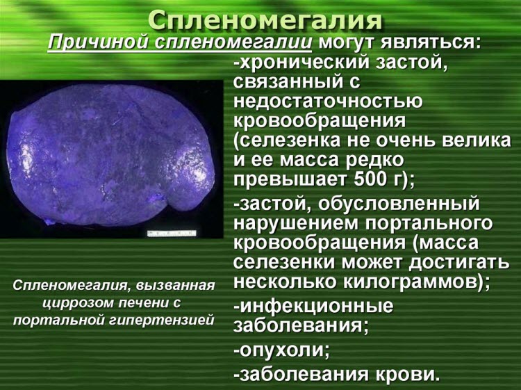 селезенка болит симптомы селезенка болит симптомы