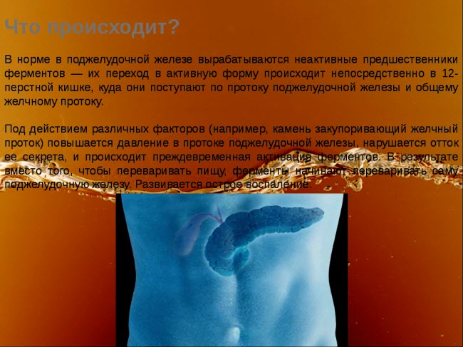 симптомы и признаки острого и хронического панкреатита симптомы и признаки острого и хронического панкреатита